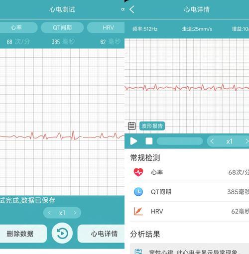 河南品牌健康监测智能手表排名前十？哪些品牌值得推荐？